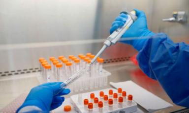 Foto referencial- Internet